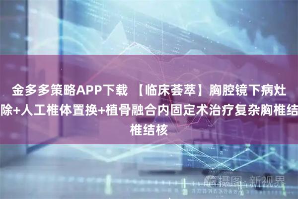 金多多策略APP下载 【临床荟萃】胸腔镜下病灶清除+人工椎体置换+植骨融合内固定术治疗复杂胸椎结核
